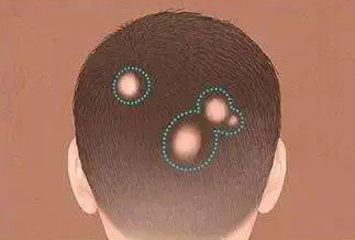 ͷƤͺһô3ɣʶ